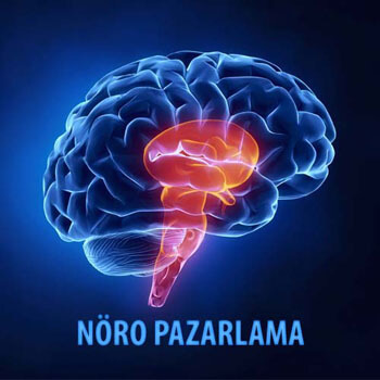 Nöro Pazarlama ve Nöro Satış